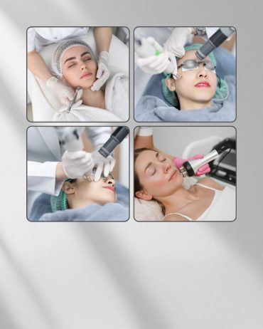 SKIN TREATMENT